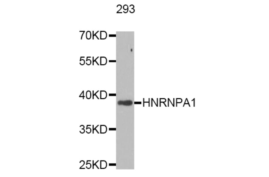 Western Blot - Anti-HNRNPA1 Antibody (A7170) - Antibodies.com