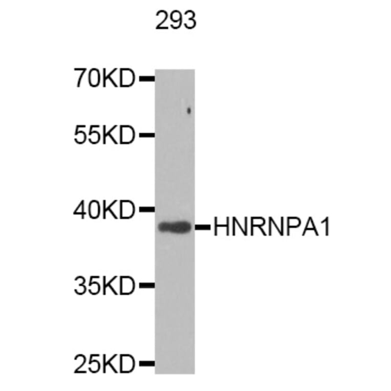 Western Blot - Anti-HNRNPA1 Antibody (A7170) - Antibodies.com