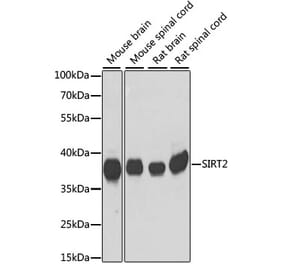 Western Blot - Anti-SIRT2 Antibody (A89680) - Antibodies.com