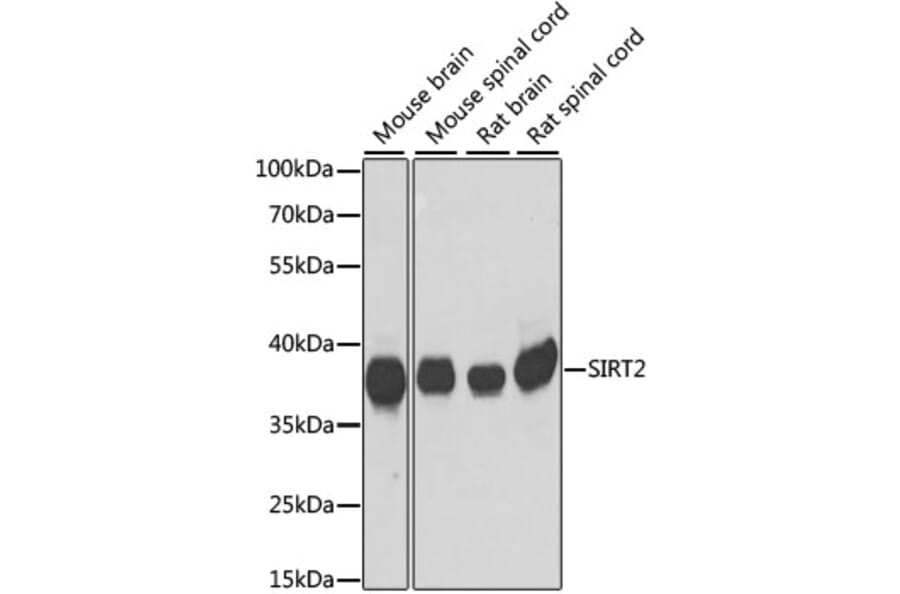 Western Blot - Anti-SIRT2 Antibody (A89680) - Antibodies.com