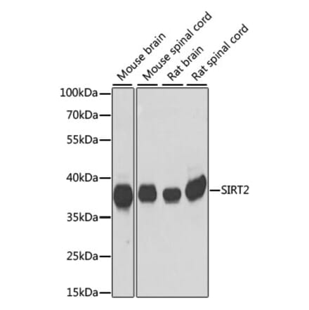Western Blot - Anti-SIRT2 Antibody (A89680) - Antibodies.com