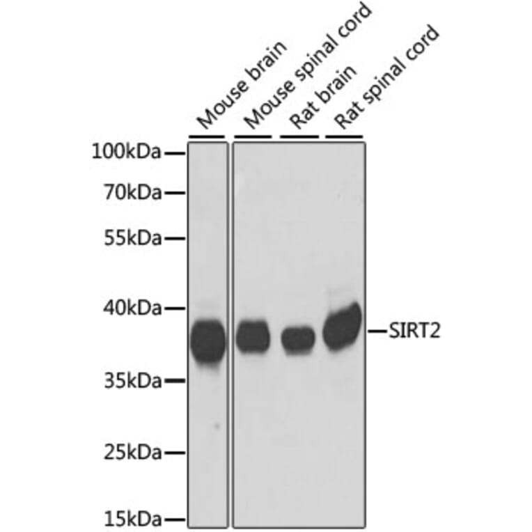 Western Blot - Anti-SIRT2 Antibody (A89680) - Antibodies.com