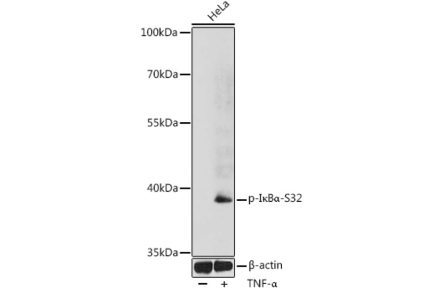 Western Blot - Anti-IKB alpha (phospho Ser32) Antibody (A89681) - Antibodies.com