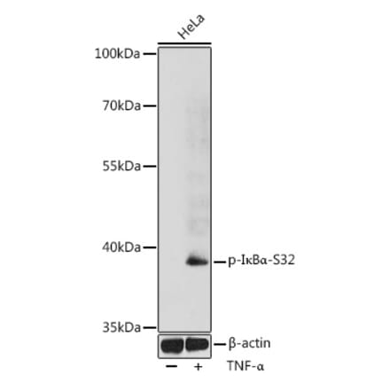 Western Blot - Anti-IKB alpha (phospho Ser32) Antibody (A89681) - Antibodies.com