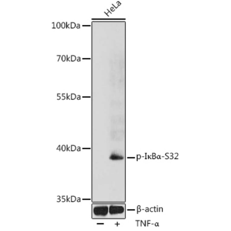 Western Blot - Anti-IKB alpha (phospho Ser32) Antibody (A89681) - Antibodies.com