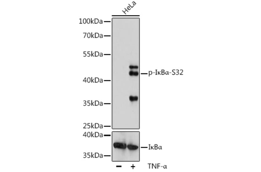 Western Blot - Anti-IKB alpha (phospho Ser32) Antibody (A89681) - Antibodies.com