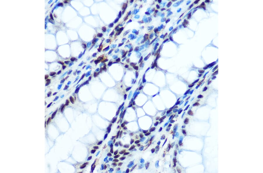 Immunohistochemistry - Anti-IKB alpha (phospho Ser32) Antibody (A89681) - Antibodies.com
