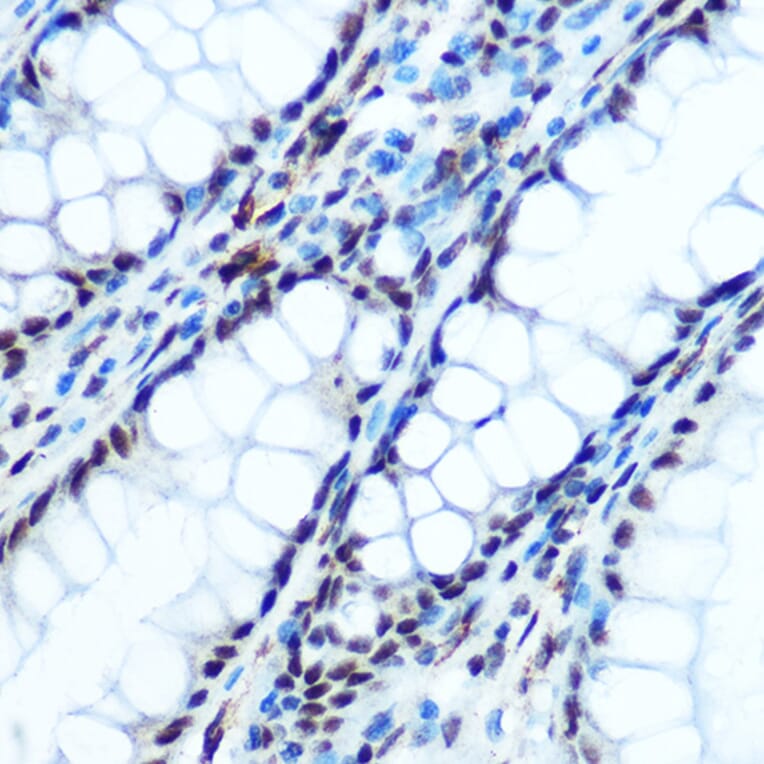 Immunohistochemistry - Anti-IKB alpha (phospho Ser32) Antibody (A89681) - Antibodies.com