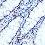 Immunohistochemistry - Anti-IKB alpha (phospho Ser32) Antibody (A89681) - Antibodies.com