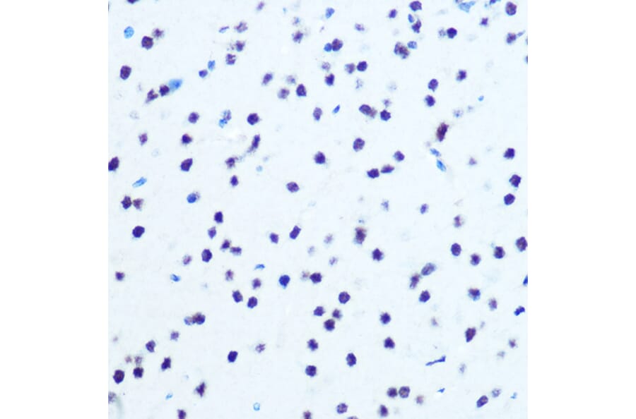 Immunohistochemistry - Anti-IKB alpha (phospho Ser32) Antibody (A89681) - Antibodies.com