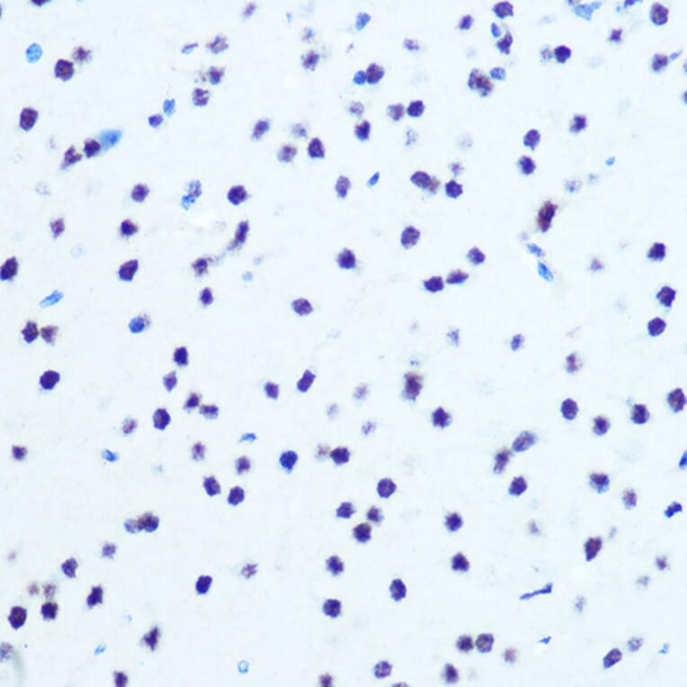 Immunohistochemistry - Anti-IKB alpha (phospho Ser32) Antibody (A89681) - Antibodies.com