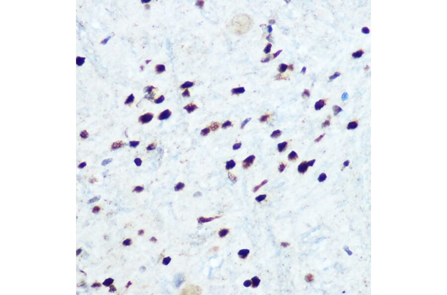 Immunohistochemistry - Anti-IKB alpha (phospho Ser32) Antibody (A89681) - Antibodies.com