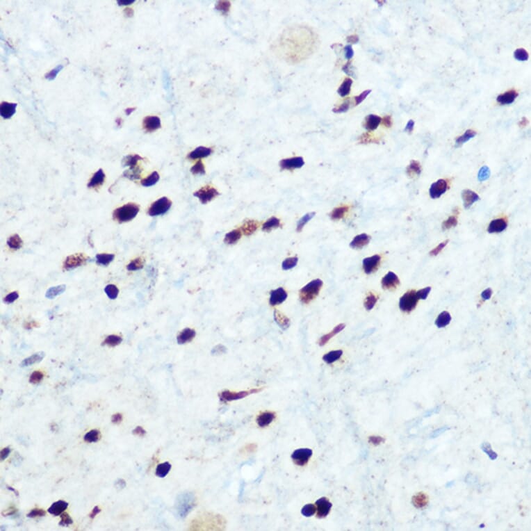 Immunohistochemistry - Anti-IKB alpha (phospho Ser32) Antibody (A89681) - Antibodies.com