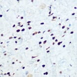 Immunohistochemistry - Anti-IKB alpha (phospho Ser32) Antibody (A89681) - Antibodies.com