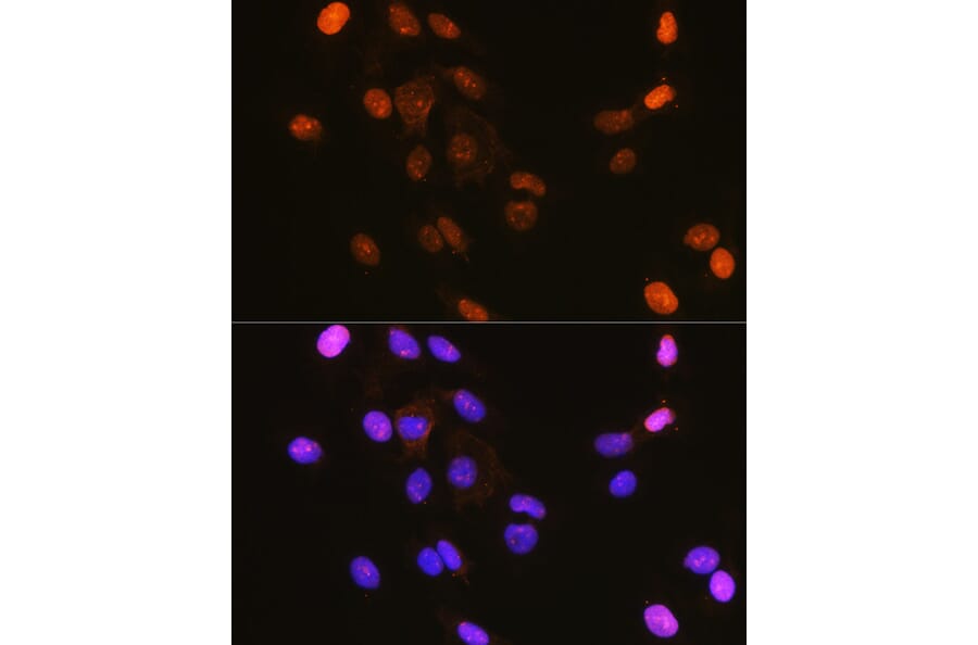Immunofluorescence - Anti-IKB alpha (phospho Ser32) Antibody (A89681) - Antibodies.com