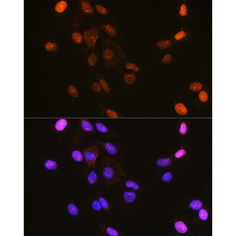 Immunofluorescence - Anti-IKB alpha (phospho Ser32) Antibody (A89681) - Antibodies.com