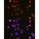Immunofluorescence - Anti-IKB alpha (phospho Ser32) Antibody (A89681) - Antibodies.com