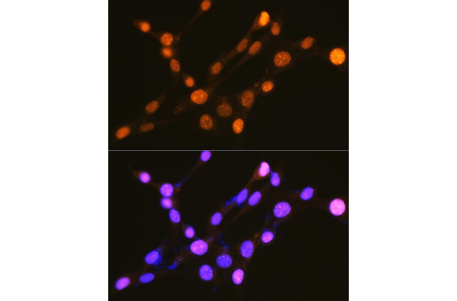 Immunofluorescence - Anti-IKB alpha (phospho Ser32) Antibody (A89681) - Antibodies.com