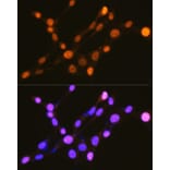 Immunofluorescence - Anti-IKB alpha (phospho Ser32) Antibody (A89681) - Antibodies.com