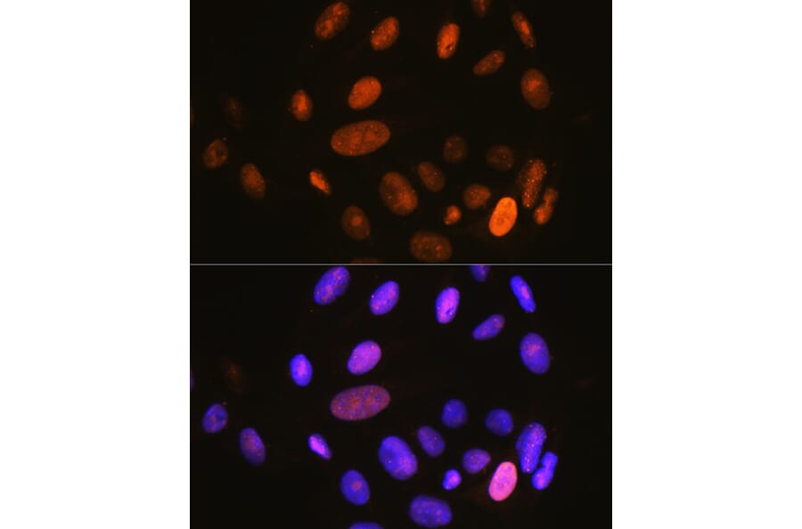 Immunofluorescence - Anti-IKB alpha (phospho Ser32) Antibody (A89681) - Antibodies.com