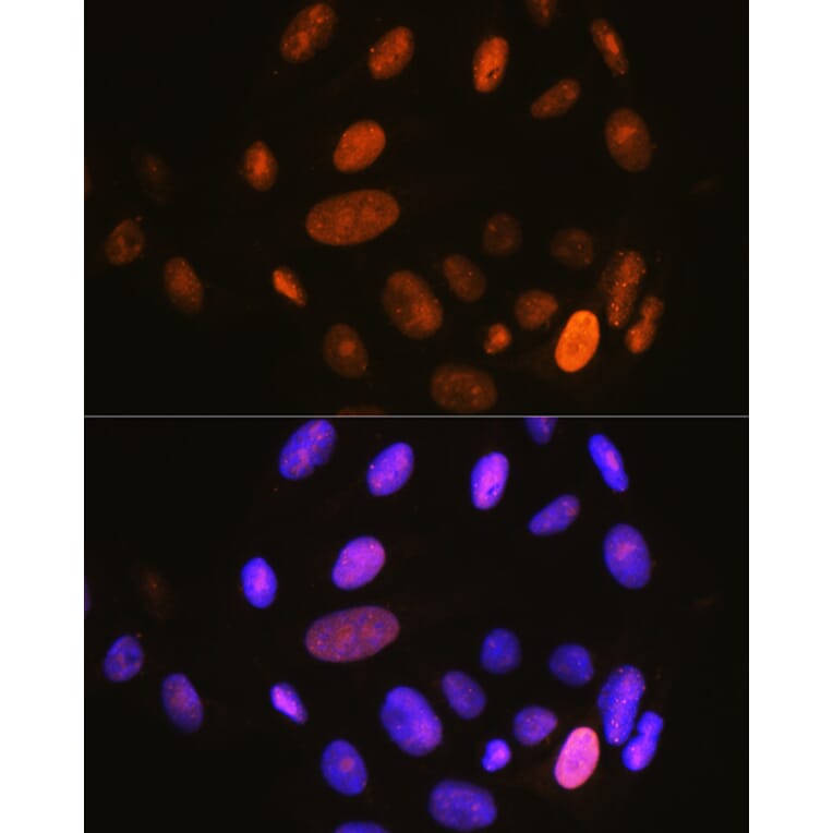 Immunofluorescence - Anti-IKB alpha (phospho Ser32) Antibody (A89681) - Antibodies.com