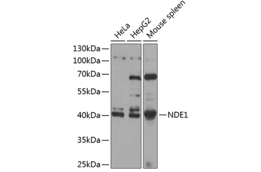 Western Blot - Anti-NDE1 Antibody (A89682) - Antibodies.com