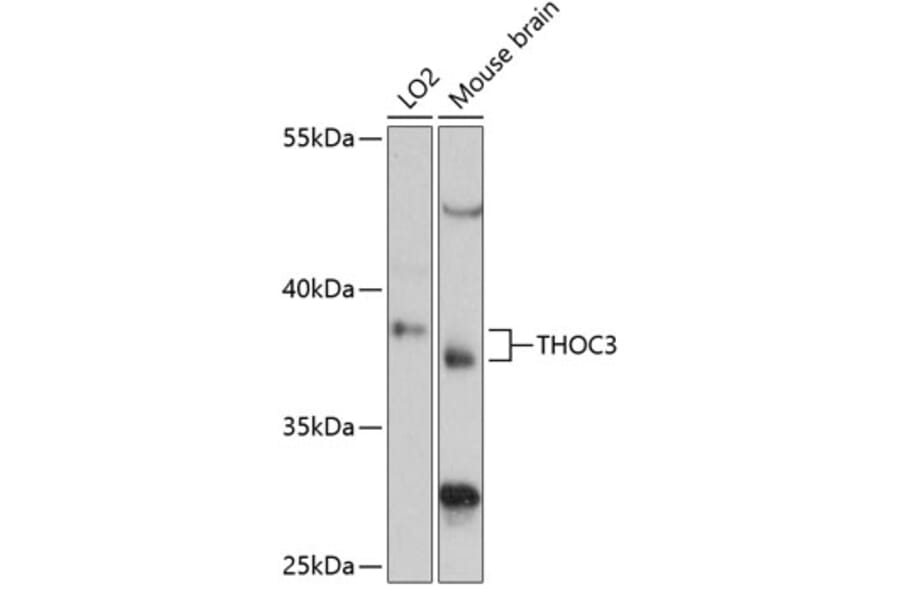 Western Blot - Anti-THOC3 Antibody (A89683) - Antibodies.com