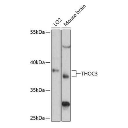 Western Blot - Anti-THOC3 Antibody (A89683) - Antibodies.com
