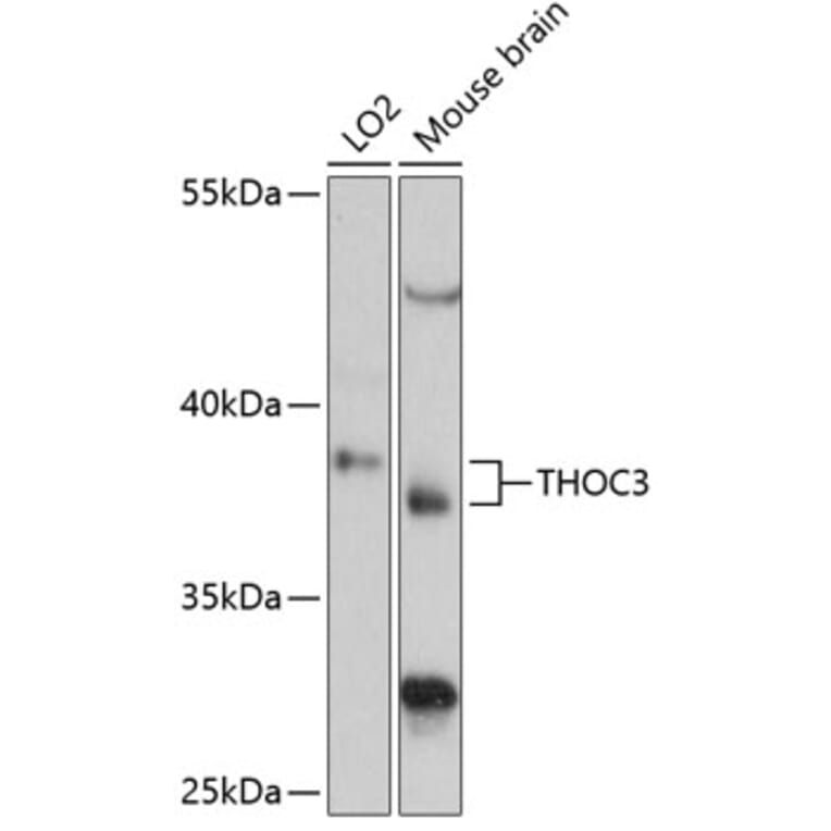 Western Blot - Anti-THOC3 Antibody (A89683) - Antibodies.com