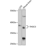 Western Blot - Anti-THOC3 Antibody (A89683) - Antibodies.com