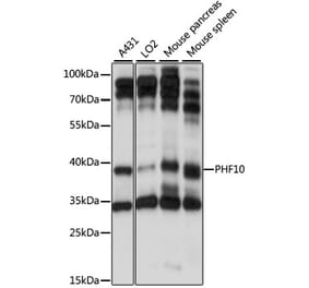 Western Blot - Anti-PHF10 Antibody (A89684) - Antibodies.com