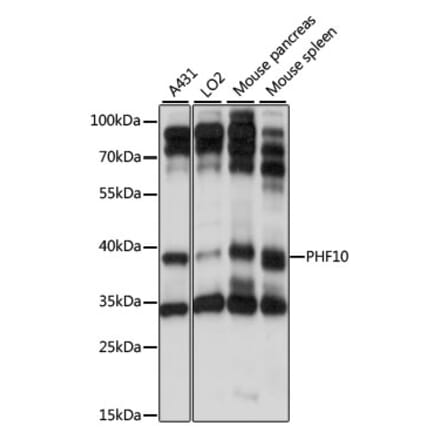 Western Blot - Anti-PHF10 Antibody (A89684) - Antibodies.com