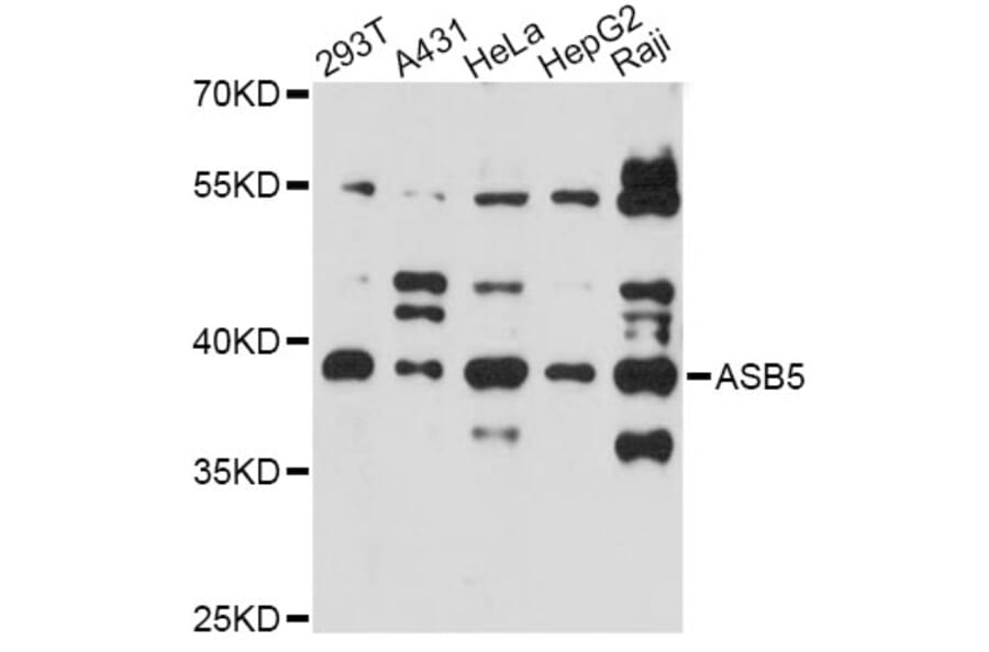 Western Blot - Anti-ASB5 Antibody (A14449) - Antibodies.com