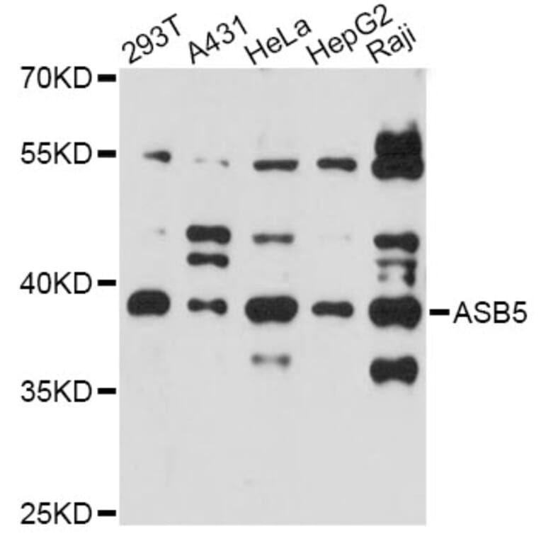 Western Blot - Anti-ASB5 Antibody (A14449) - Antibodies.com