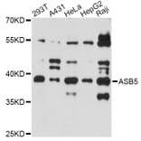 Western Blot - Anti-ASB5 Antibody (A14449) - Antibodies.com