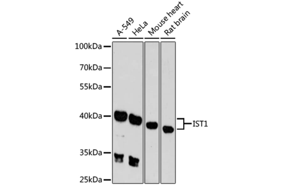 Western Blot - Anti-IST1 Antibody (A89687) - Antibodies.com
