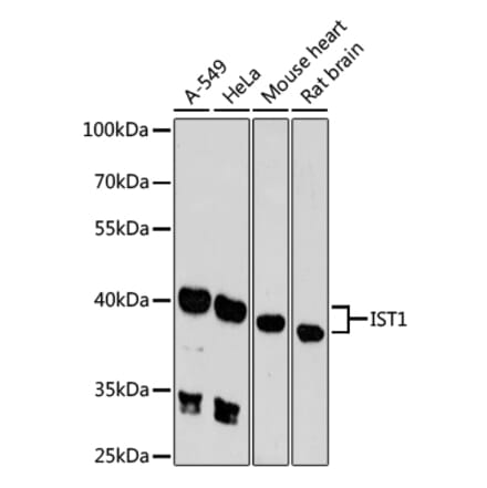 Western Blot - Anti-IST1 Antibody (A89687) - Antibodies.com