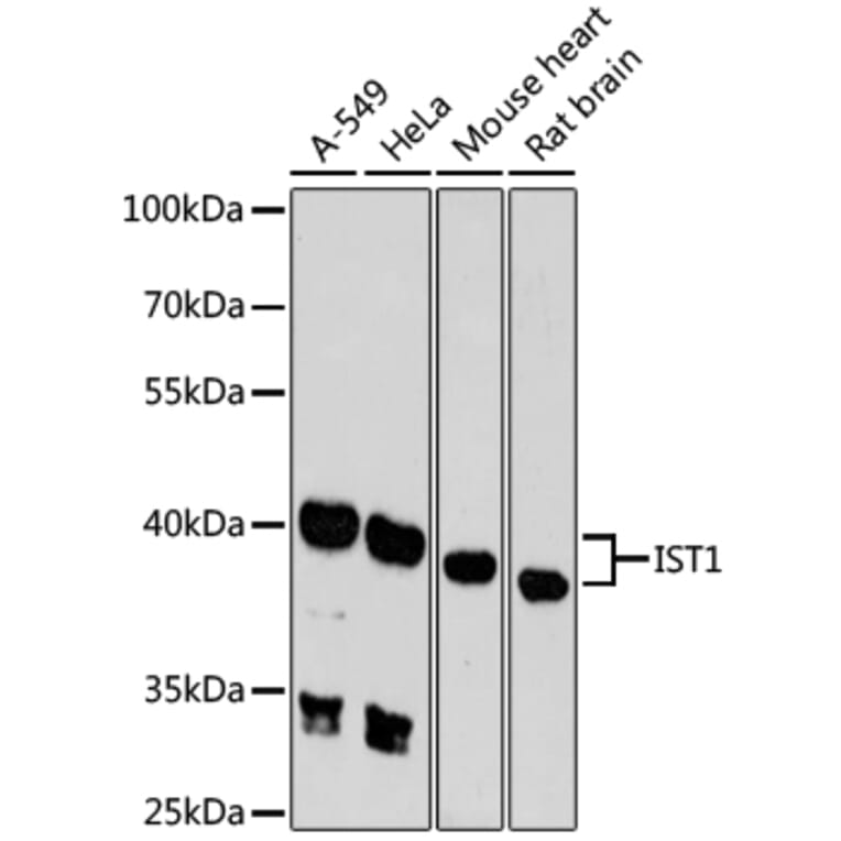 Western Blot - Anti-IST1 Antibody (A89687) - Antibodies.com