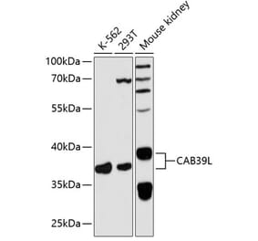 Western Blot - Anti-CAB39L Antibody (A89688) - Antibodies.com