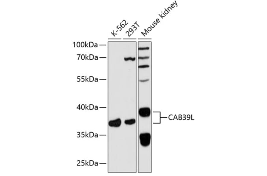 Western Blot - Anti-CAB39L Antibody (A89688) - Antibodies.com