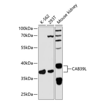 Western Blot - Anti-CAB39L Antibody (A89688) - Antibodies.com