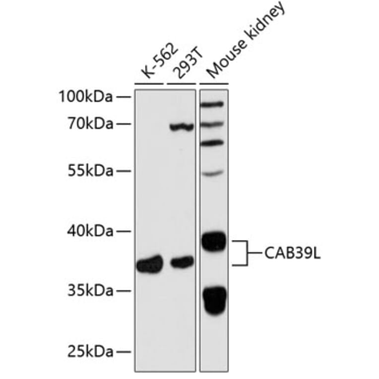 Western Blot - Anti-CAB39L Antibody (A89688) - Antibodies.com