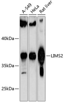 Western blot analysis of extracts of various cell lines, using Anti-LIMS2 Antibody (A13225) at 1:1,000 dilution.
Secondary antibody: Goat Anti-Rabbit IgG (H+L) (HRP) (AS014) at 1:10,000 dilution.
Lysates / proteins: 25µg per lane.
Blocking buffer: 3% non-fat dry milk in TBST.
Detection: ECL Basic Kit (RM00020).
Exposure time: 60s.