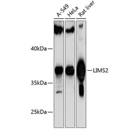 Western Blot - Anti-PINCH-2 Antibody (A89689) - Antibodies.com