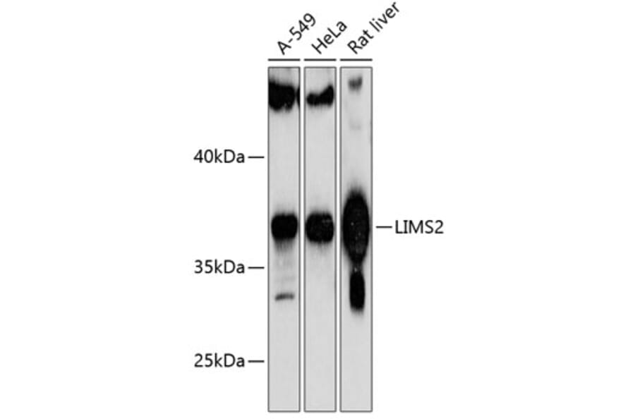 Western Blot - Anti-PINCH-2 Antibody (A89689) - Antibodies.com