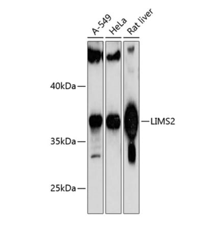 Western Blot - Anti-PINCH-2 Antibody (A89689) - Antibodies.com