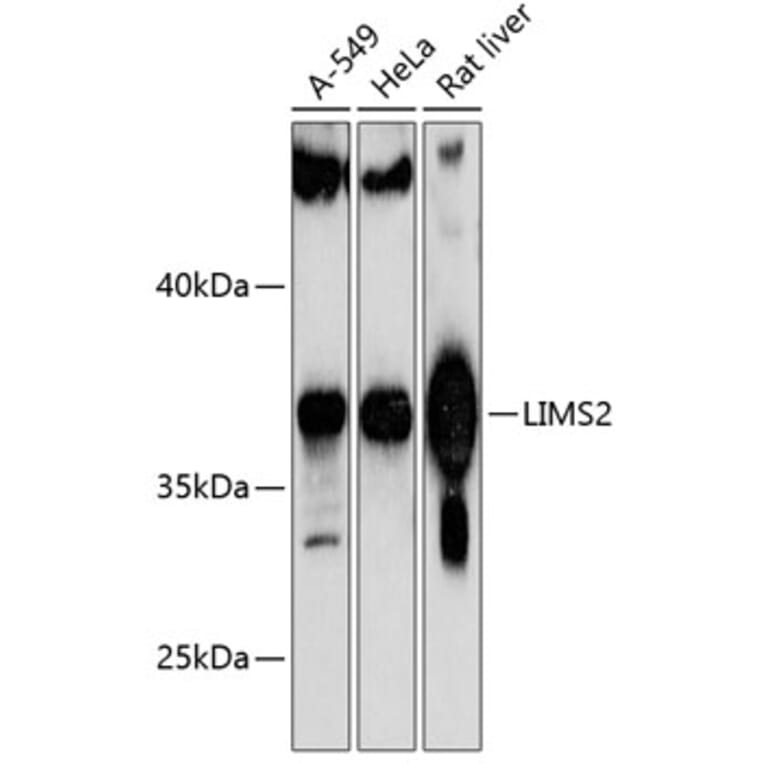 Western Blot - Anti-PINCH-2 Antibody (A89689) - Antibodies.com