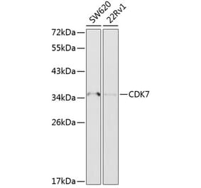 Western Blot - Anti-Cdk7 Antibody (A89690) - Antibodies.com
