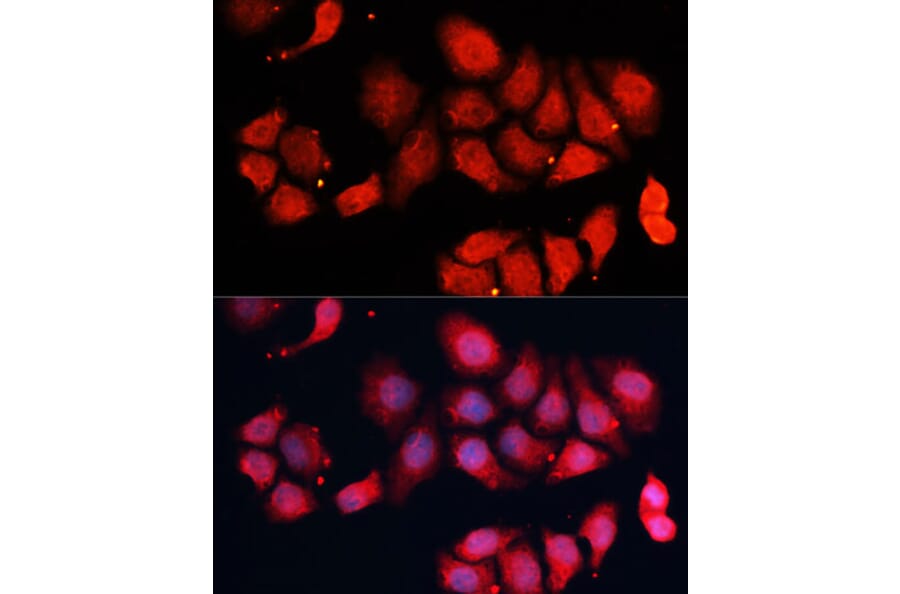 Immunofluorescence - Anti-Cdk7 Antibody (A89690) - Antibodies.com