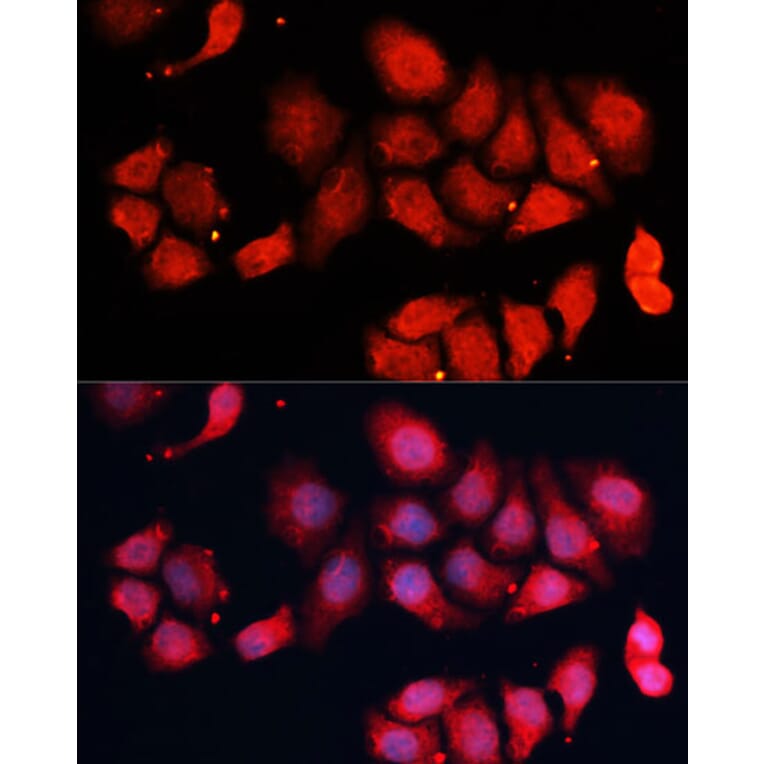 Immunofluorescence - Anti-Cdk7 Antibody (A89690) - Antibodies.com